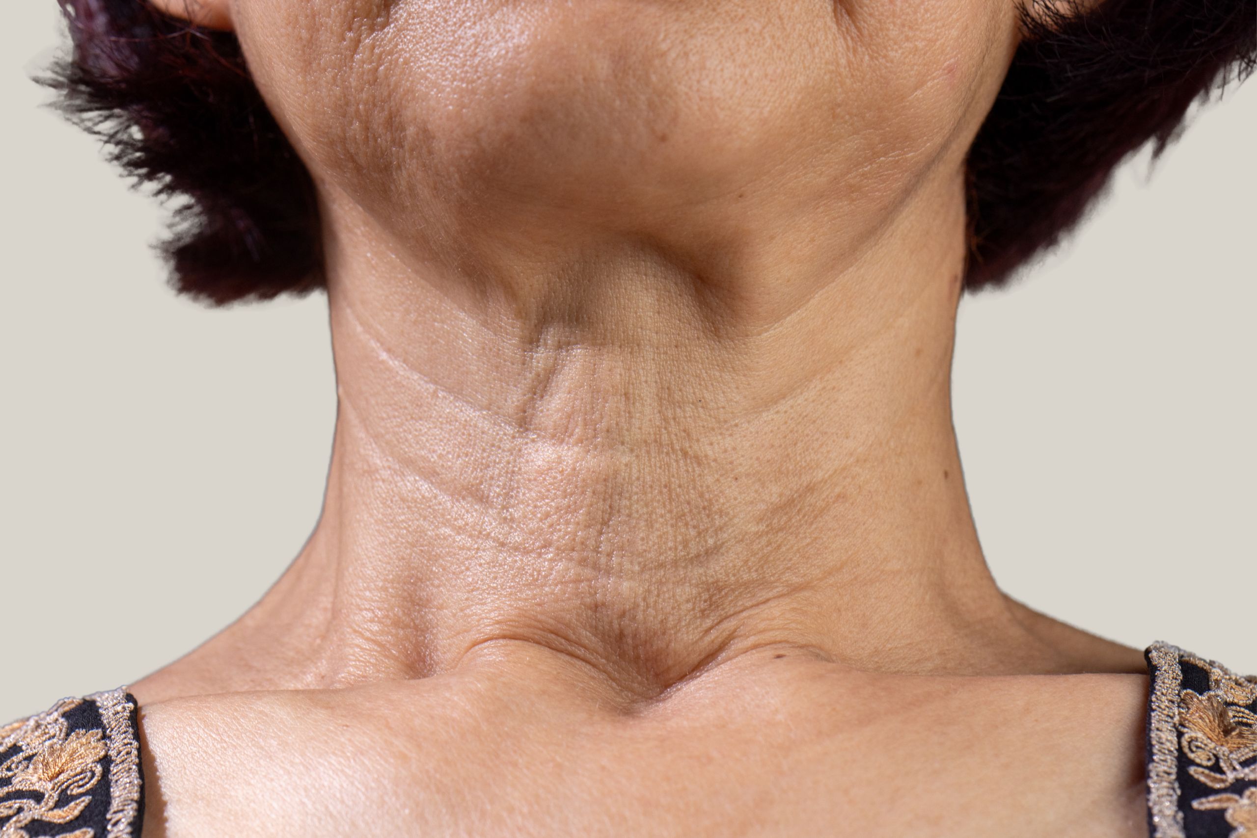 Tech Neck Aesthetic and Skincare Solutions for Horizontal Neck Lines STORY Blog